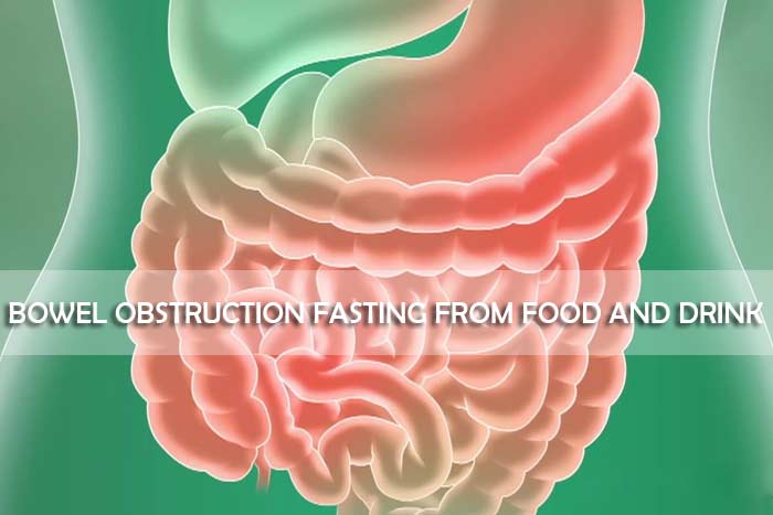bowel obstruction fasting from food and drink