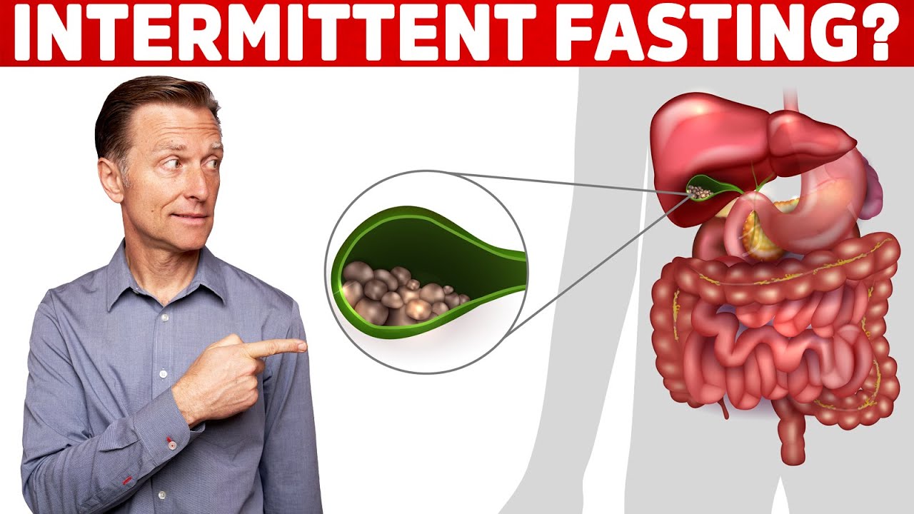 Does Intermittent Fasting Cause Gallstones?