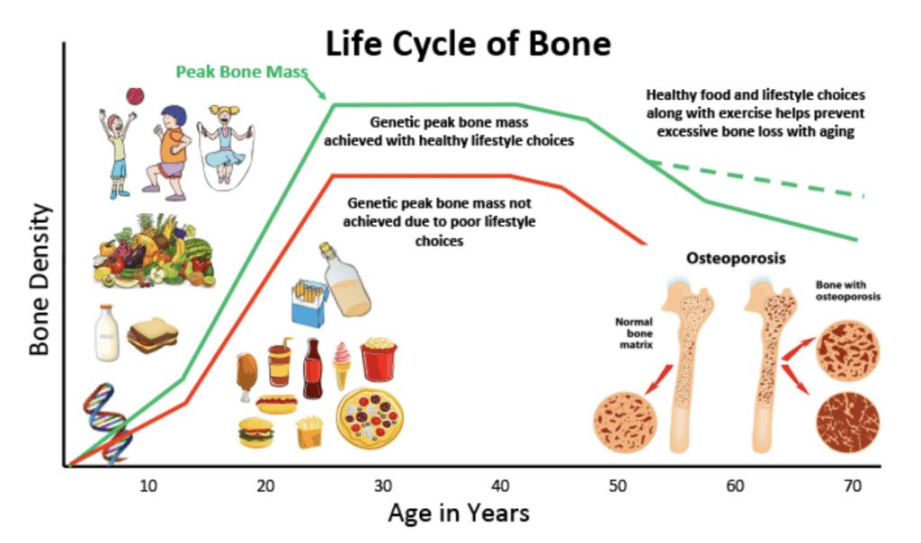 What's the Connection Between Healthy Eating and Bone Health?